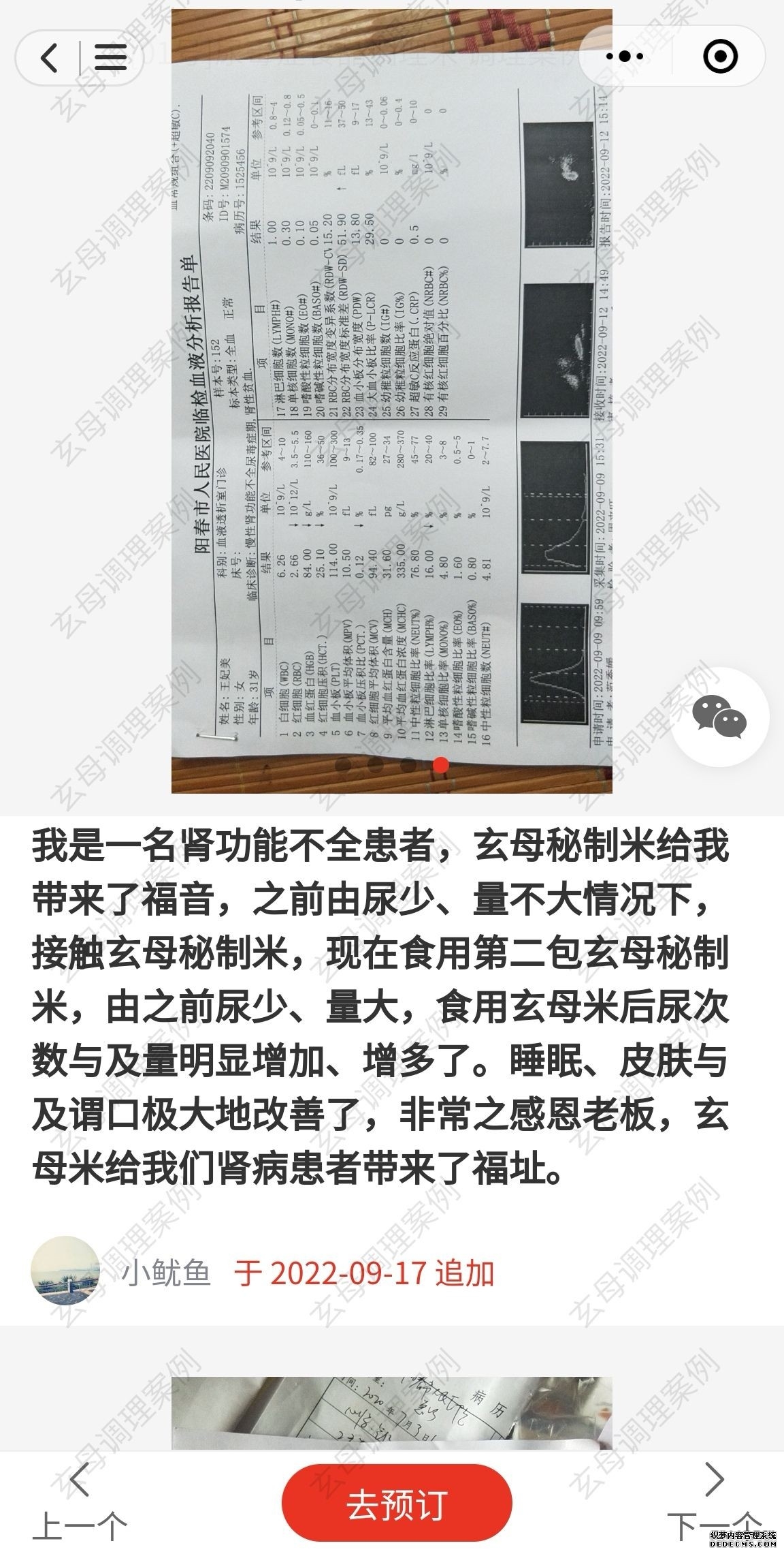 尿毒症症状 做透析痛苦吗 玄母米能治愈吗