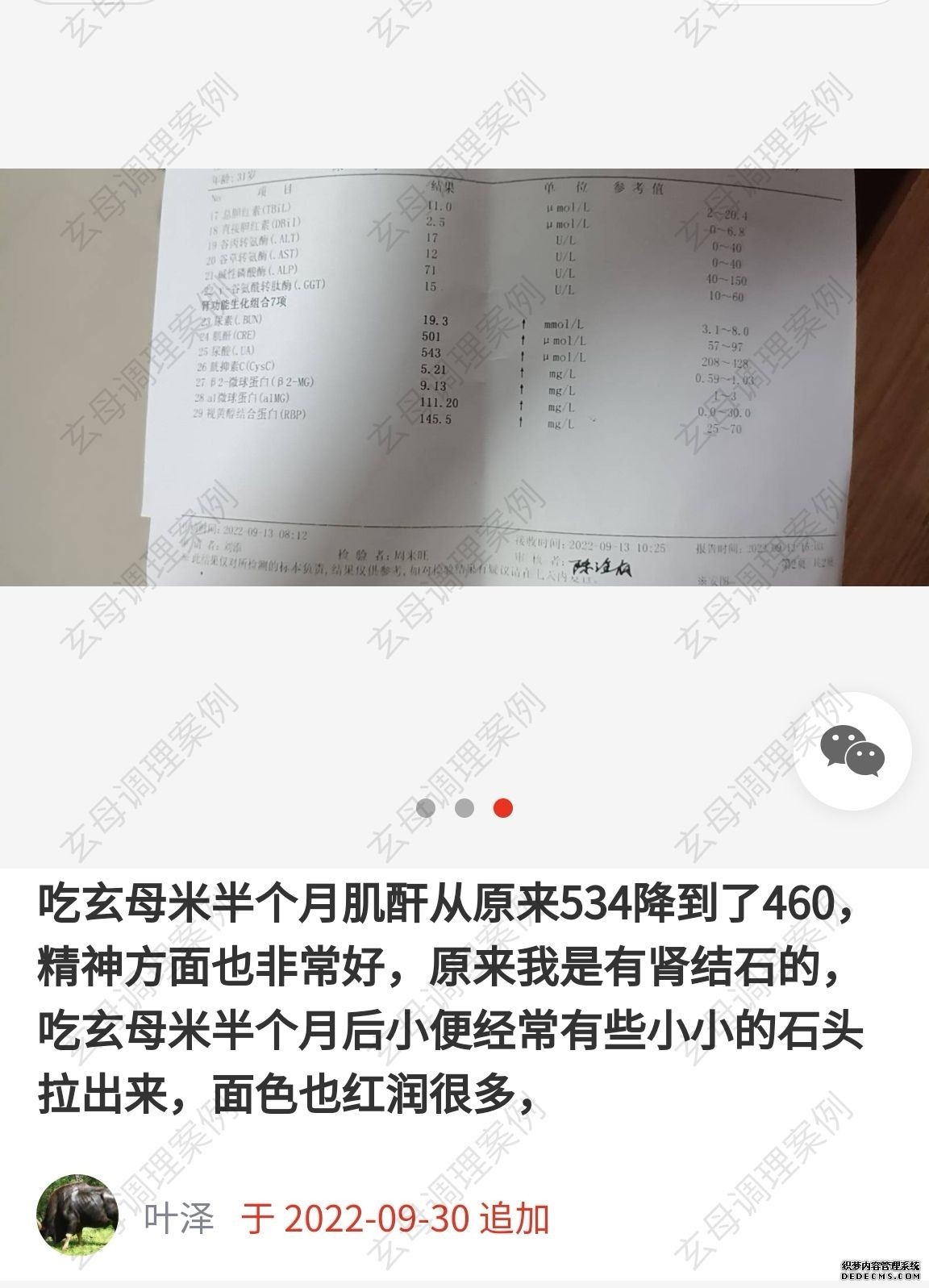 尿毒症症状 做透析痛苦吗 玄母米能治愈吗