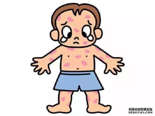 艾滋病感染者初期会出现哪些症状（艾滋病感染的早期表现和自我诊断策略）(12)