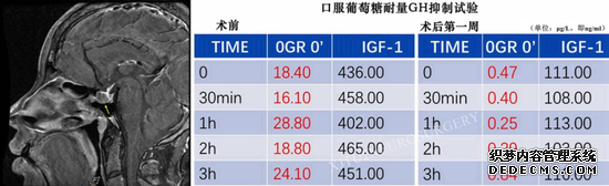 西安交大二附院：打呼噜！居然另有玄机~~~