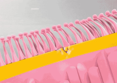 现在的肺炎是如何产生的（肺炎是怎样形成的）(3)