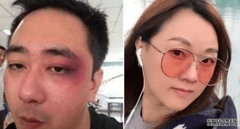 王自健被前妻打进医院8次？前妻硬气否认，那他